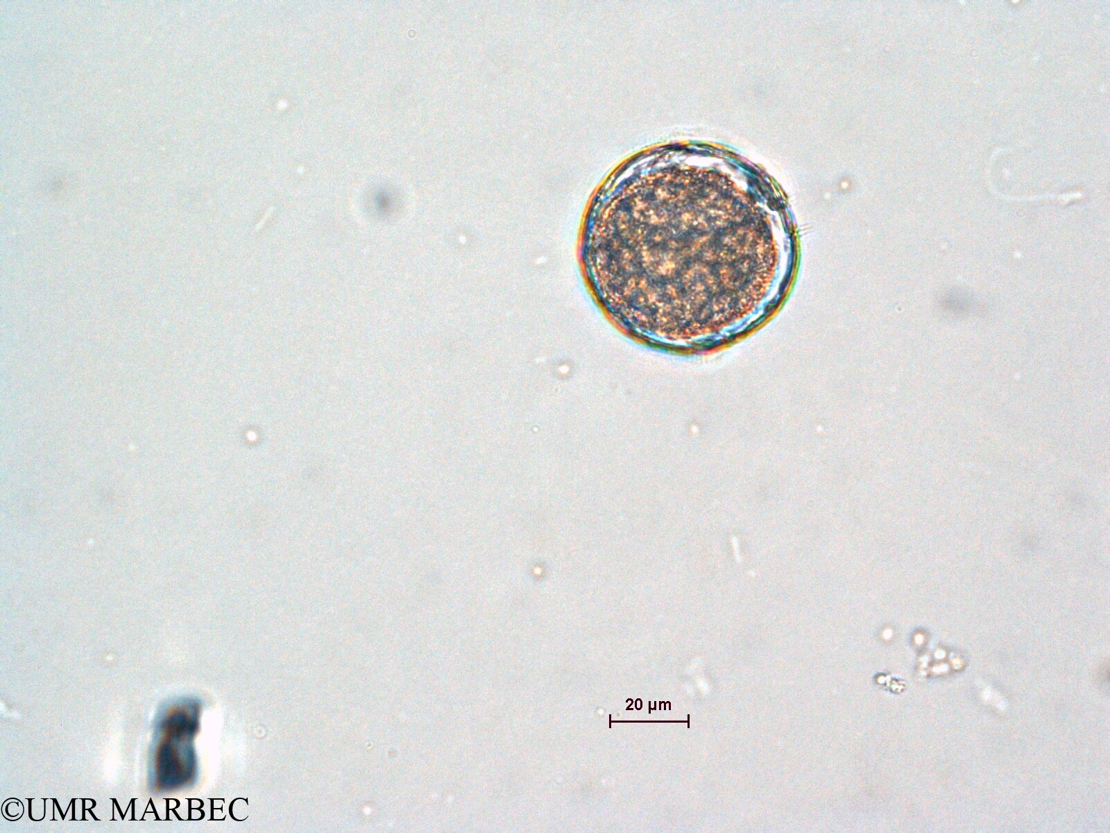 phyto/Scattered_Islands/all/COMMA April 2011/Protoperidinium sp11  (ancien Protoperidinium sp5 recomposé)(copy).jpg